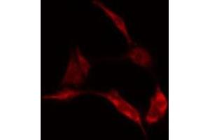 ABIN6278151 staining  Hela cells by IF/ICC. (LGALS1/Galectin 1 抗体)