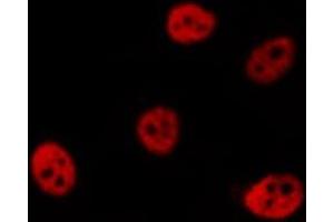 ABIN6277000 staining  Hela cells by IF/ICC. (PSMC3 抗体)