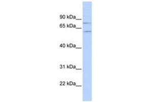 Image no. 1 for anti-Protein Inhibitor of Activated STAT, 1 (PIAS1) (N-Term) antibody (ABIN6742834) (PIAS1 抗体  (N-Term))