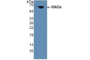 Detection of Recombinant PKCq, Human using Polyclonal Antibody to Protein Kinase C Theta (PKCq) (PKC theta 抗体  (AA 380-634))