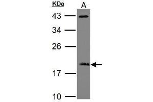 WB Image Sample (30 ug of whole cell lysate) A: Raji 12% SDS PAGE ADP-ribosylation factor 3 antibody antibody diluted at 1:1000 (ARF3 抗体)
