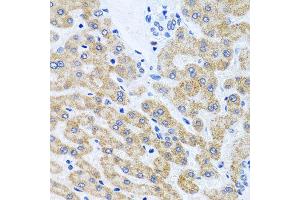 Immunohistochemistry of paraffin-embedded human liver using SCO1 antibody at dilution of 1:100 (x40 lens). (SCO1 抗体)