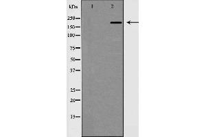 Western blot analysis of MAP2 expression in mouse brain,The lane on the left is treated with the antigen-specific peptide. (MAP2 抗体  (N-Term))