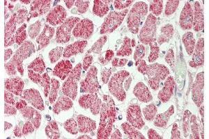 Rabbit Anti-Rps12 antibody Catalog Number: ARP51260 Formalin Fixed Paraffin Embedded Tissue: Human Heart Primary antibody Concentration: 1:100 Secondary Antibody: Donkey anti-Rabbit-Cy3 Secondary Antibody Concentration: 1:200 Magnification: 20x Exposure Time: 0. (RPS12 抗体  (C-Term))