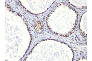 Image no. 1 for anti-Androgen Receptor (AR) (AA 299-315) antibody (ABIN6156150) (Androgen Receptor 抗体  (AA 299-315))