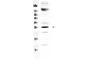 Western blot analysis of SRY using anti-SRY antibody . (SRY 抗体  (Middle Region))