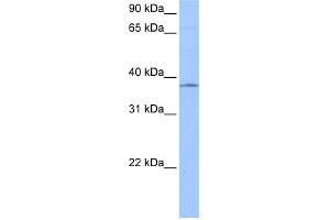 WB Suggested Anti-SPRY2 Antibody Titration:  0. (SPRY2 抗体  (N-Term))