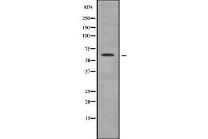 Western blot analysis of TRIM35 using HuvEc whole cell lysates (TRIM35 抗体  (N-Term))