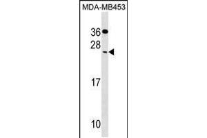 Western blot analysis in MDA-MB453 cell line lysates (35ug/lane).