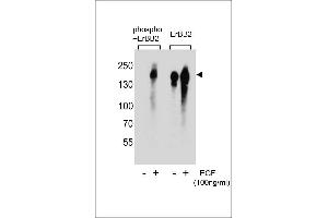 Western blot analysis of extracts from A431 cell,untreated or treated with EGF,using phospho-ERBB2- (left) or ErBB2 Antibody (right). (ErbB2/Her2 抗体  (pTyr1005))
