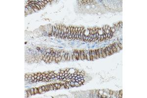 Immunohistochemistry (IHC) image for anti-Catenin (Cadherin-Associated Protein), delta 1 (CTNND1) (AA 573-832) antibody (ABIN3022309)