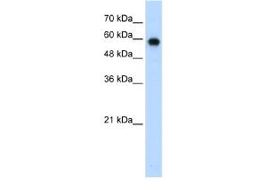 WB Suggested Anti-SMARCD2 Antibody Titration:  0.