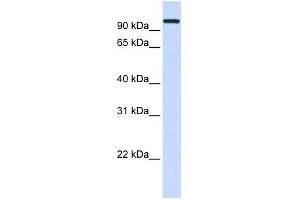 HSPA4 antibody used at 1 ug/ml to detect target protein. (HSPA4 抗体  (Middle Region))