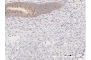 Immunostaining (ISt) image for anti-Progesterone Immunomodulatory Binding Factor 1 (PIBF1) (AA 660-755) antibody (ABIN564559)