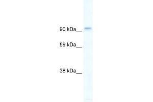 WB Suggested Anti-PIK3CB Antibody Titration:  5ug/ml  Positive Control:  Human brain