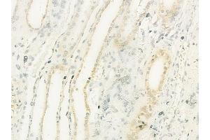 ABIN6260934 and ABIN6273212 at 1/100 staining human normal kidney tissue by IHC-P. (COLEC11 抗体  (C-Term))