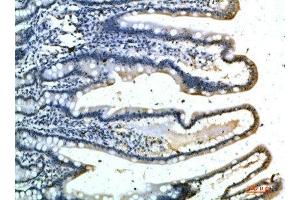 Immunohistochemical analysis of paraffin-embedded human-colon, antibody was diluted at 1:200 (Selectin E/CD62e 抗体)