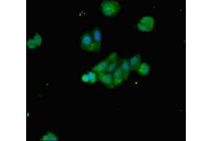Immunofluorescent analysis of HepG2 cells using ABIN7145302 at dilution of 1:100 and Alexa Fluor 488-congugated AffiniPure Goat Anti-Rabbit IgG(H+L) (BIM 抗体  (AA 1-198))