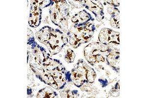 Immunohistochemistry of paraffin embedded human placenta using CCRL2 (ABIN7073461) at dilution of 1:300 (400x lens) (CCRL2 抗体)
