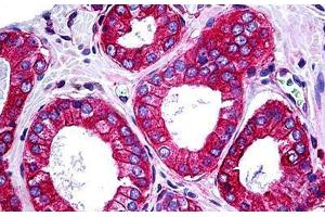 Human Prostate: Formalin-Fixed, Paraffin-Embedded (FFPE) (TRAF3IP2 抗体  (AA 451-566))