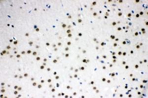 IHC analysis of SF2/SRSF1 using anti-SF2/SRSF1 antibody (ABIN3043296).
