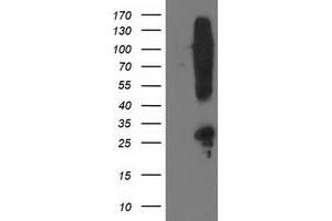 HEK293T cells were transfected with the pCMV6-ENTRY control (Left lane) or pCMV6-ENTRY SNAP25 (Right lane) cDNA for 48 hrs and lysed. (SNAP25 抗体)