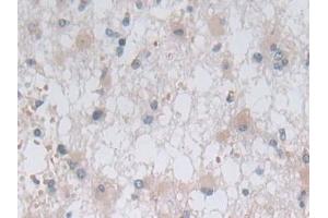 Immunohistochemistry (IHC) image for anti-Ornithine Aminotransferase (OAT) (AA 1-301) antibody (ABIN7441106)
