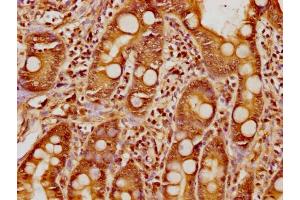 IHC image of nphHU diluted at 1:8 and staining in paraffin-embedded human small intestine tissue performed on a Leica BondTM system. (Histone H1.5 抗体  (AA 14-25))
