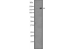 Western blot analysis of PARP4 expression in Hela cell lysate,The lane on the left is treated with the antigen-specific peptide. (PARP4 抗体  (Internal Region))