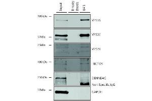 Immunoprecipitation (IP) image for anti-Vacuolar Protein Sorting 35 (VPS35) antibody (PE) (ABIN6932978)
