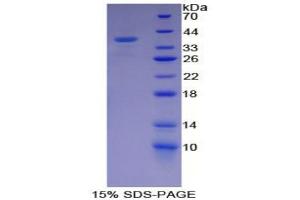SDS-PAGE analysis of Mouse CAPN1 Protein. (CAPNL1 蛋白)