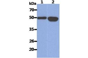 The Recombinant Human KRT14 (50ng) and Cell lysates (40ug) were resolved by SDS-PAGE, transferred to PVDF membrane and probed with anti-human KRT14 antibody (1:1000). (KRT14 抗体)