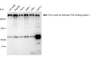 Western blotting analysis using Chromodomain helicase DNA binding protein 4 antibody (ABIN7800918). (Recombinant Chromodomain Helicase DNA Binding 4 抗体)