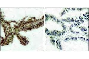 Immunohistochemistry (IHC) image for anti-V-Akt Murine Thymoma Viral Oncogene Homolog 1/2 (AKT1/2) (pThr308) antibody (ABIN2888353) (AKT1/2 抗体  (pThr308))