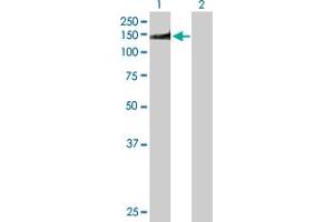 Western Blot analysis of NUMA1 expression in transfected 293T cell line by NUMA1 MaxPab polyclonal antibody. (NUMA1 抗体  (AA 1-1193))