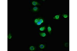 Immunofluorescence staining of A549 cells with ABIN7165136 at 1:133, counter-stained with DAPI. (BICC1 抗体  (AA 682-849))