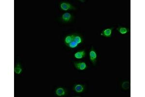 Immunofluorescence staining of A549 cells with ABIN7165136 at 1:133, counter-stained with DAPI.
