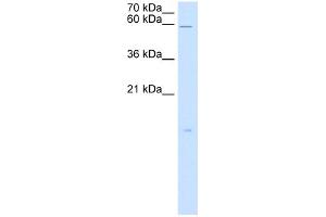 WB Suggested Anti-RARRES3 Antibody Titration:  5.