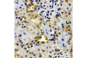 Immunohistochemical analysis of EPHX2 staining in rat kidney formalin fixed paraffin embedded tissue section. (EPHX2 抗体)