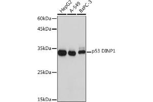Western blot analysis of extracts of various cell lines, using p53 DINP1 Rabbit mAb (ABIN7271097) at 1:1000 dilution. (TP53INP1 抗体)