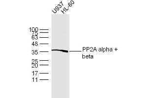 Lane 1: U937 lysates Lane 2: HL-60 lysates probed with PP2A alpha + beta Polyclonal Antibody, Unconjugated  at 1:300 dilution and 4˚C overnight incubation. (PP2A alpha/beta 抗体  (AA 205-309))