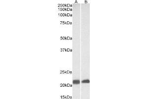 Western Blotting (WB) image for Caveolin 3 (CAV3) peptide (ABIN370342)