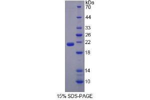 SDS-PAGE analysis of Mouse EPRS Protein. (EPRS 蛋白)