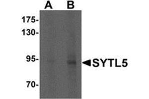Western blot analysis of SYTL5 in Hela cell lysate with SYTL5 antibody at (A) 1 and (B) 2 μg/ml. (SYTL5 抗体  (N-Term))