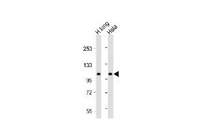 All lanes : Anti-NAT10 Antibody (N-Term) at 1:2000 dilution Lane 1: Human lung lysate Lane 2: Hela whole cell lysate Lysates/proteins at 20 μg per lane.