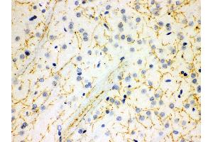 Immunohistochemistry (IHC) image for anti-Solute Carrier Family 6 (Neurotransmitter Transporter, serotonin), Member 4 (SLC6A4) (AA 57-85), (N-Term) antibody (ABIN3043931)