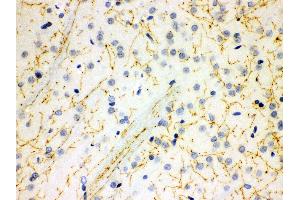 Anti- SLC6A4 Picoband antibody, IHC(P) IHC(P): Rat Brain Tissue