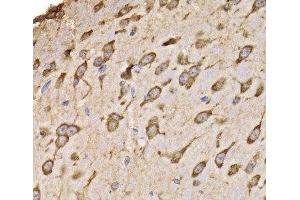 Immunohistochemistry of paraffin-embedded Mouse brain using RPS14 Polyclonal Antibody at dilution of 1:100 (40x lens). (RPS14 抗体)