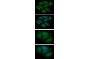 ICC/IF analysis of CNBP in HeLa cells line, stained with DAPI (Blue) for nucleus staining and monoclonal anti-human CNBP antibody (1:100) with goat anti-mouse IgG-Alexa fluor 488 conjugate (Green). (CNBP 抗体)