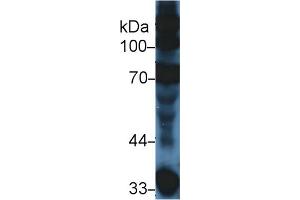 Western Blot; Sample: Mouse Serum; Primary Ab: 5µg/ml Rabbit Anti-Mouse C3a Antibody Second Ab: 0. (C3a 抗体  (AA 671-748))